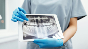 flat panel detectors for X-ray LA