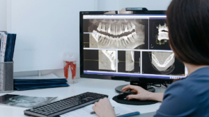 digital x-ray panels
