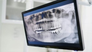 DR panels Los Angeles