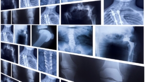 medical imaging industry