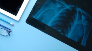 Digital X-ray panels Southern California