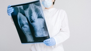 digital radiography (DR) panels